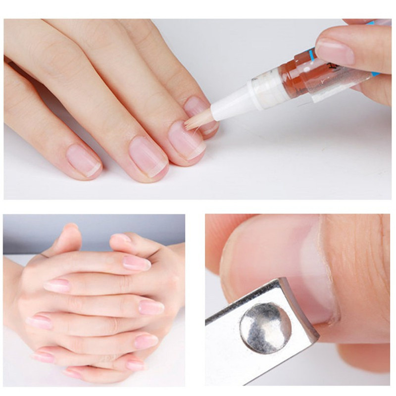 4Pcs-Biological-Toenail-Fungus-Stop-Pencil-Anti-Fungal-Nail-Treatment-Toenails-Fingernail-1312625